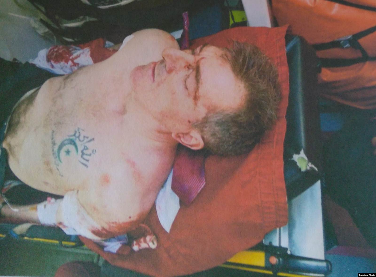 Раненый Артур Кринари (Алекс Вернер). Источник: материалы дела