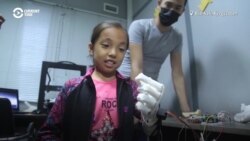 Kyrgyzstan's Bionic Arm For A Better World